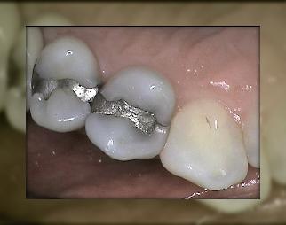 Advanced Dental Care
