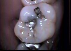 Advanced Dental Care