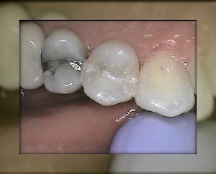 Advanced Dental Care