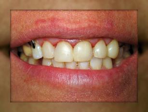 Advanced Dental Care