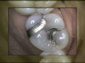 Advanced Dental Care