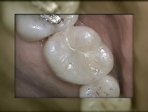 Advanced Dental Care