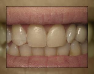 Advanced Dental Care