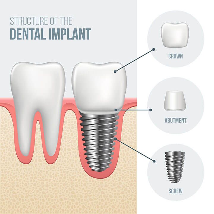 Advanced Dental Care