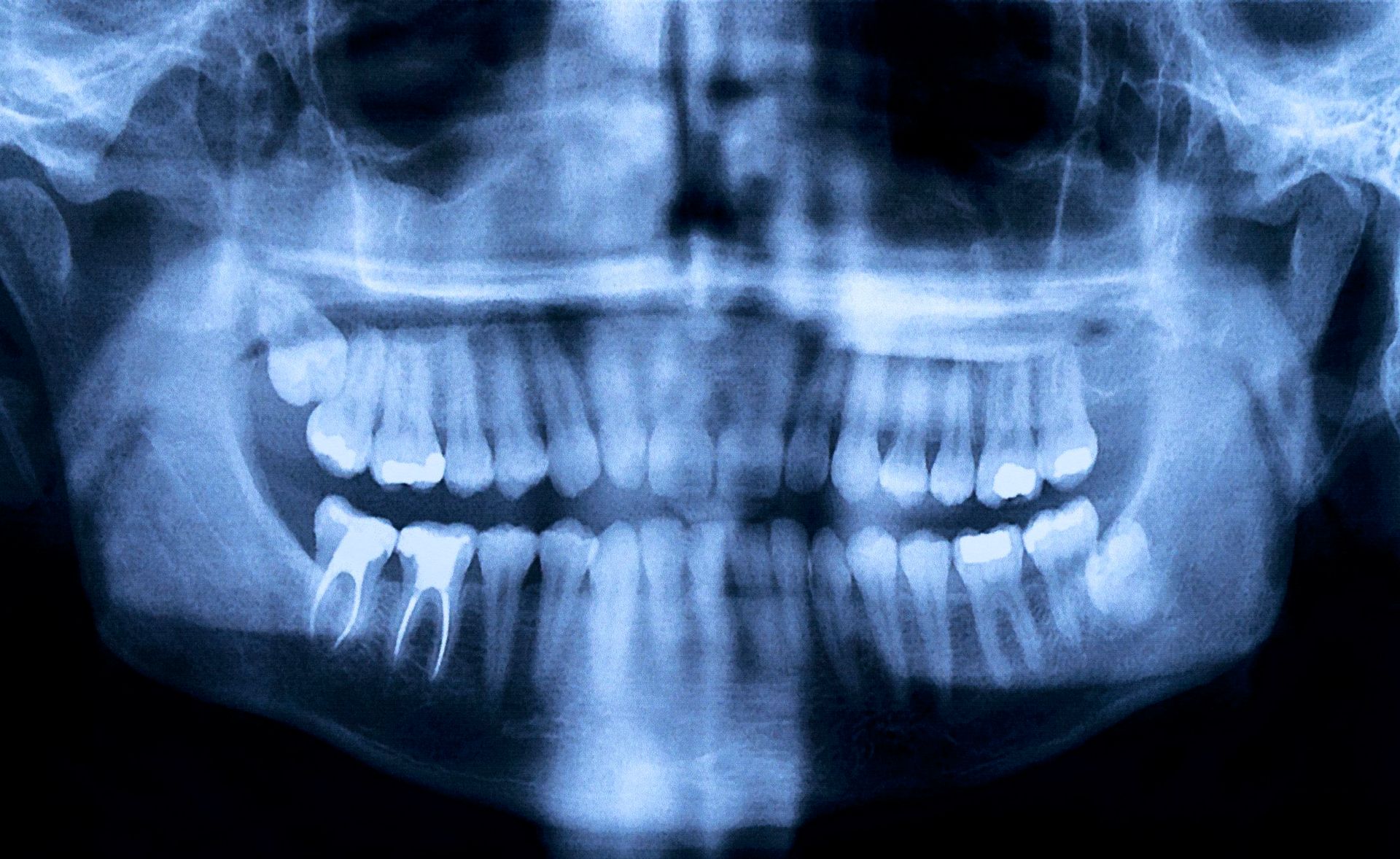 woman with a toothache woman with a toothache