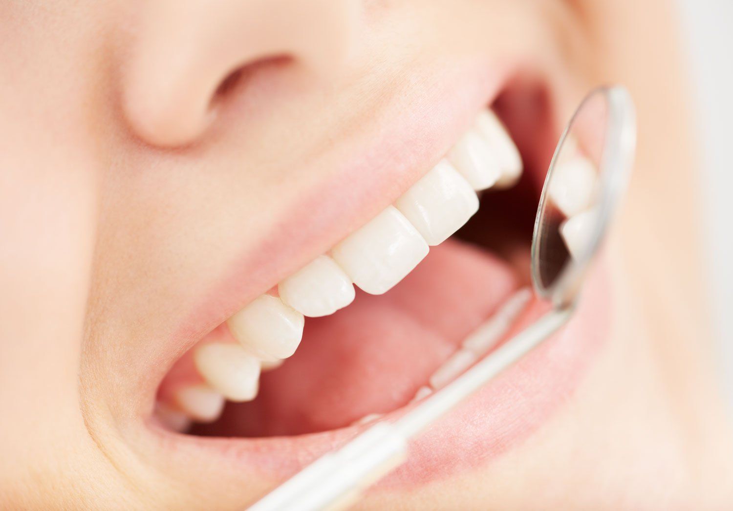 Dental examination dental examination