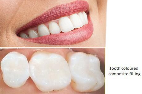 teeth