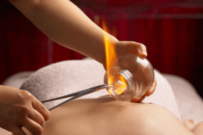 Cupping