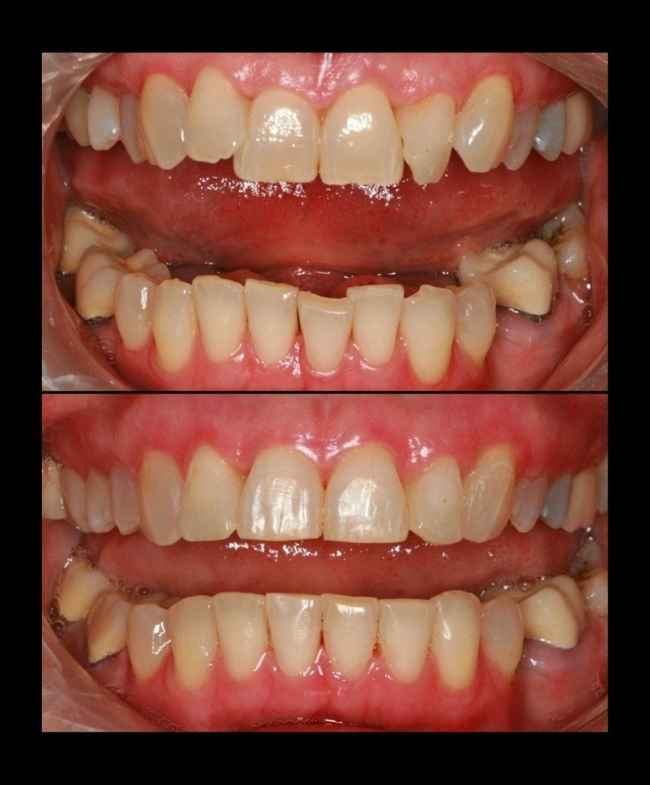 Cosmetic Ortho