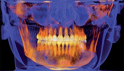 3D digital imaging equipment in Eagle River, AK
