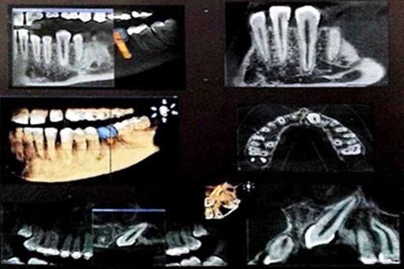Radiografie mediche