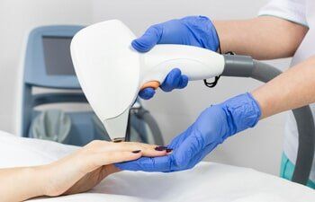 Laser Treatments — Hands having a Skin Treatment in Slidell, LA
