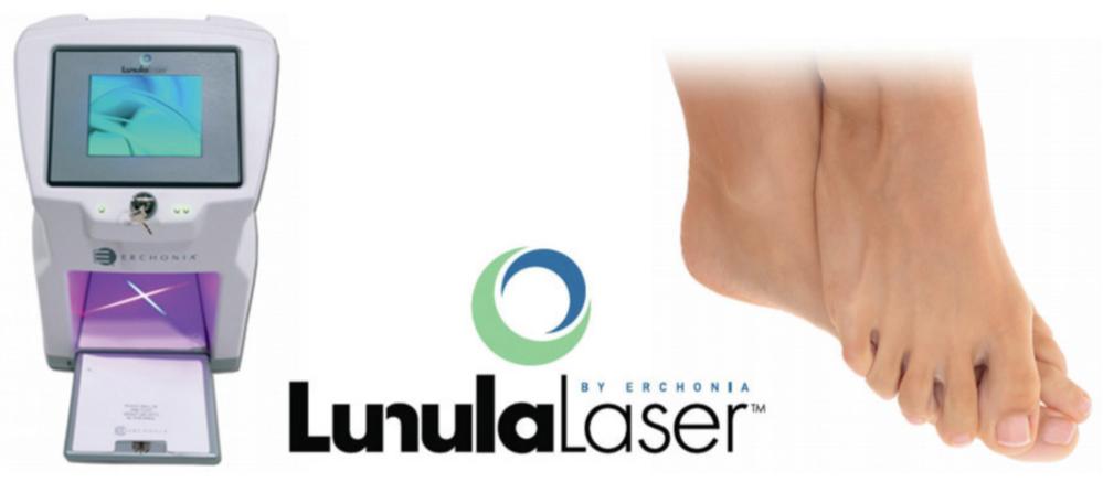 Lunar Laser