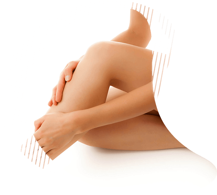 epilazione