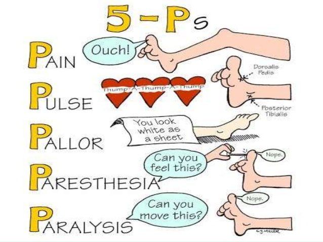 Neurovascular Assessment 