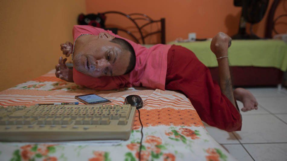 A man with no legs is laying on a bed next to a keyboard and mouse.