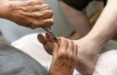 Hard skin removal
