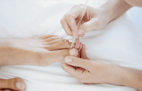 Help avoid ingrown toenails