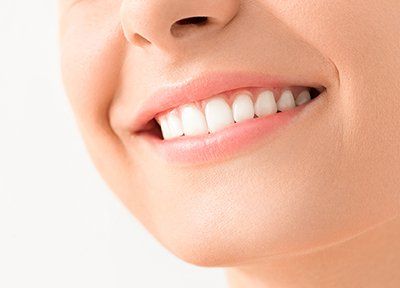 Dentists — Girl Beautiful Smile in El Paso, TX Dentists — Girl Beautiful Smile in El Paso, TX