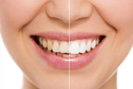 Dental Care — Cosmetic Dentistry in Oakhurst, CA