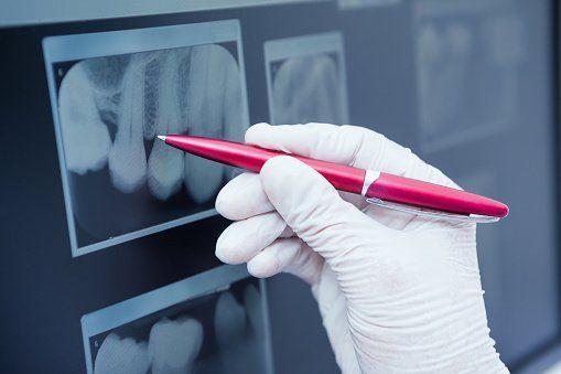 Teeth X-Ray — X-Rays in Oakhurst, CA Teeth X-Ray — X-Rays in Oakhurst, CA