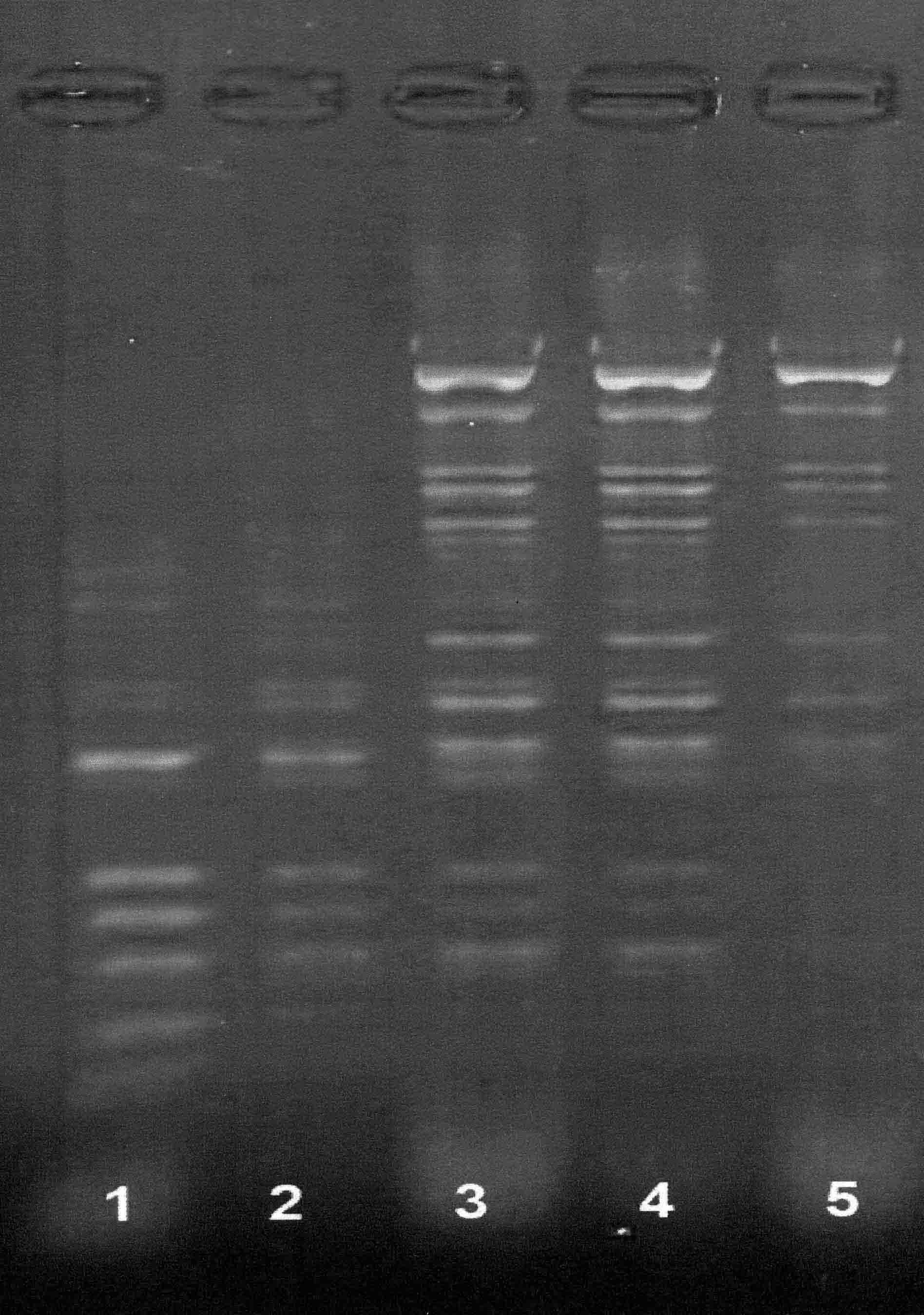 Agarosegelelektrophorese. DNA-Bänder in fünf Spuren visualisiert, die eine Vielzahl von Fragmentgrößen zeigen.