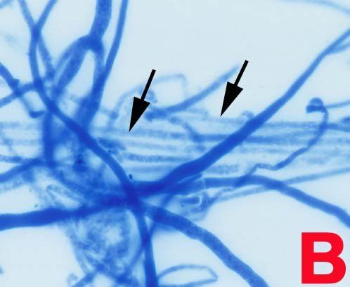 Mikroskopische Ansicht blau gefärbter Pilzhyphen mit Pfeilen, die auf bestimmte Strukturen zeigen.