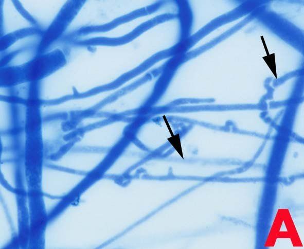 Mikroskopische Ansicht blauer Pilzhyphen mit sich entwickelnden Sporenstrukturen, die durch Pfeile angezeigt werden.