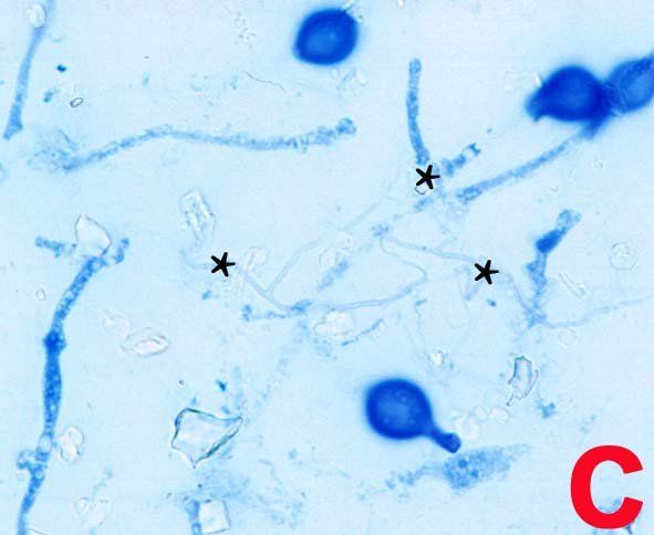 Mikroskopische Ansicht: Blau gefärbte Pilzhyphen mit runden Strukturen und Verzweigungen.