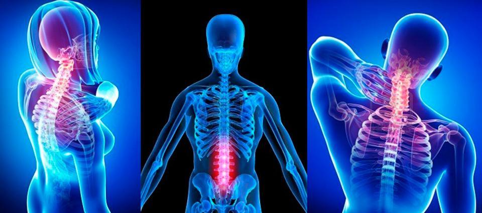 Skelton — Margate, FL — Light of Life Chiropractic, LLC Skelton — Margate, FL — Light of Life Chiropractic, LLC