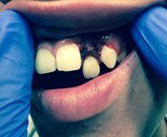 treatment7