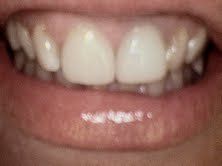 treatment9