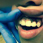 treatment8