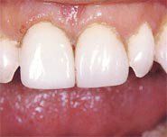 treatment4