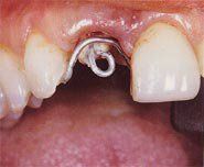 treatment3