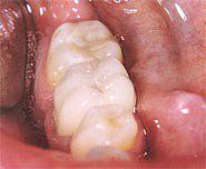 treatment6