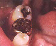 treatment5
