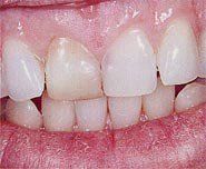 treatment1