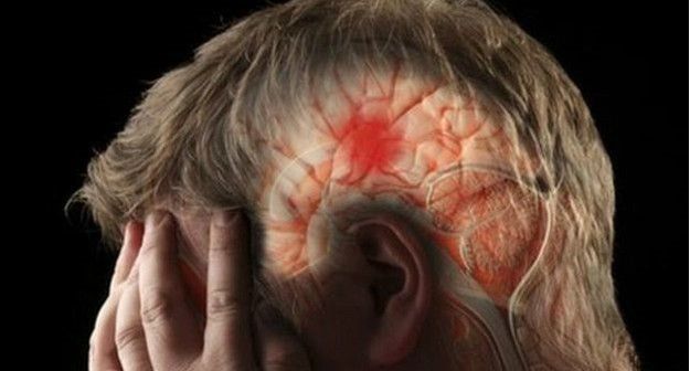 Coágulo en el cerebro