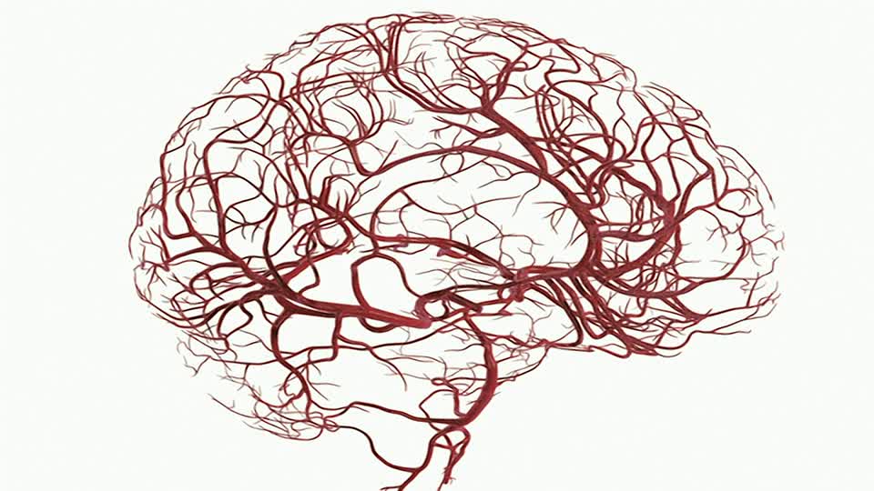 Arteria Cerebral Media