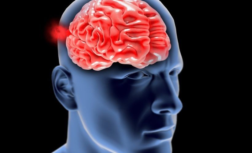 Aneurisma Cerebral