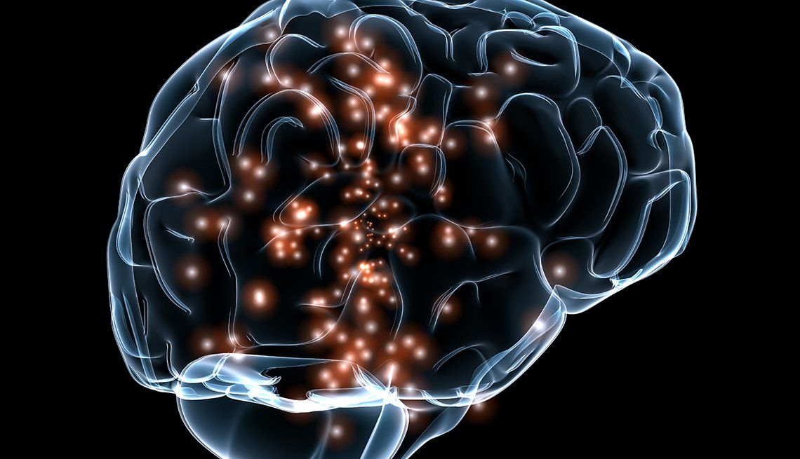 enfermedades cerebrovasculares enfermedades cerebrovasculares