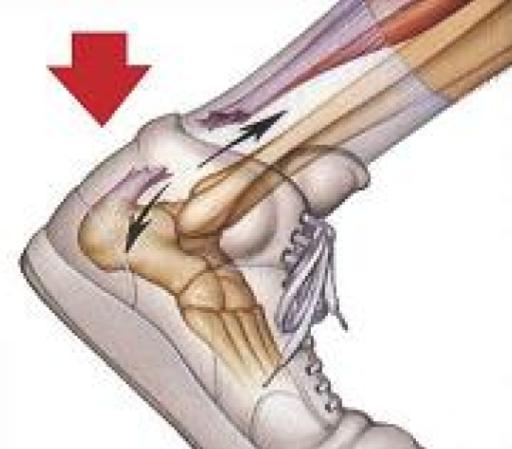 A drawing of a person 's foot with a red arrow pointing down.