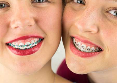 Two Girls with Braces - Family Orthodontist in Tonawanda, NY Two Girls with Braces - Family Orthodontist in Tonawanda, NY