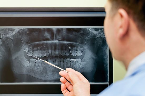 Dentist examining teeth on digital X-Ray Dentist examining teeth on digital X-Ray