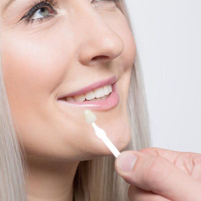 Dental Crowns - Dansville Family Dental Care
