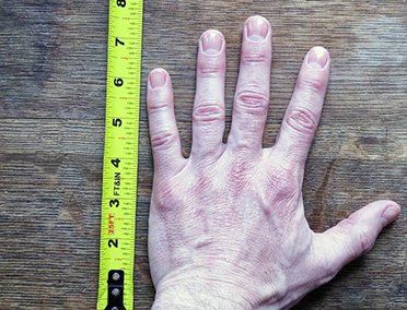 HANDS