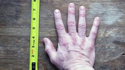 HANDS