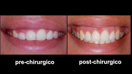 Estetica del sorriso