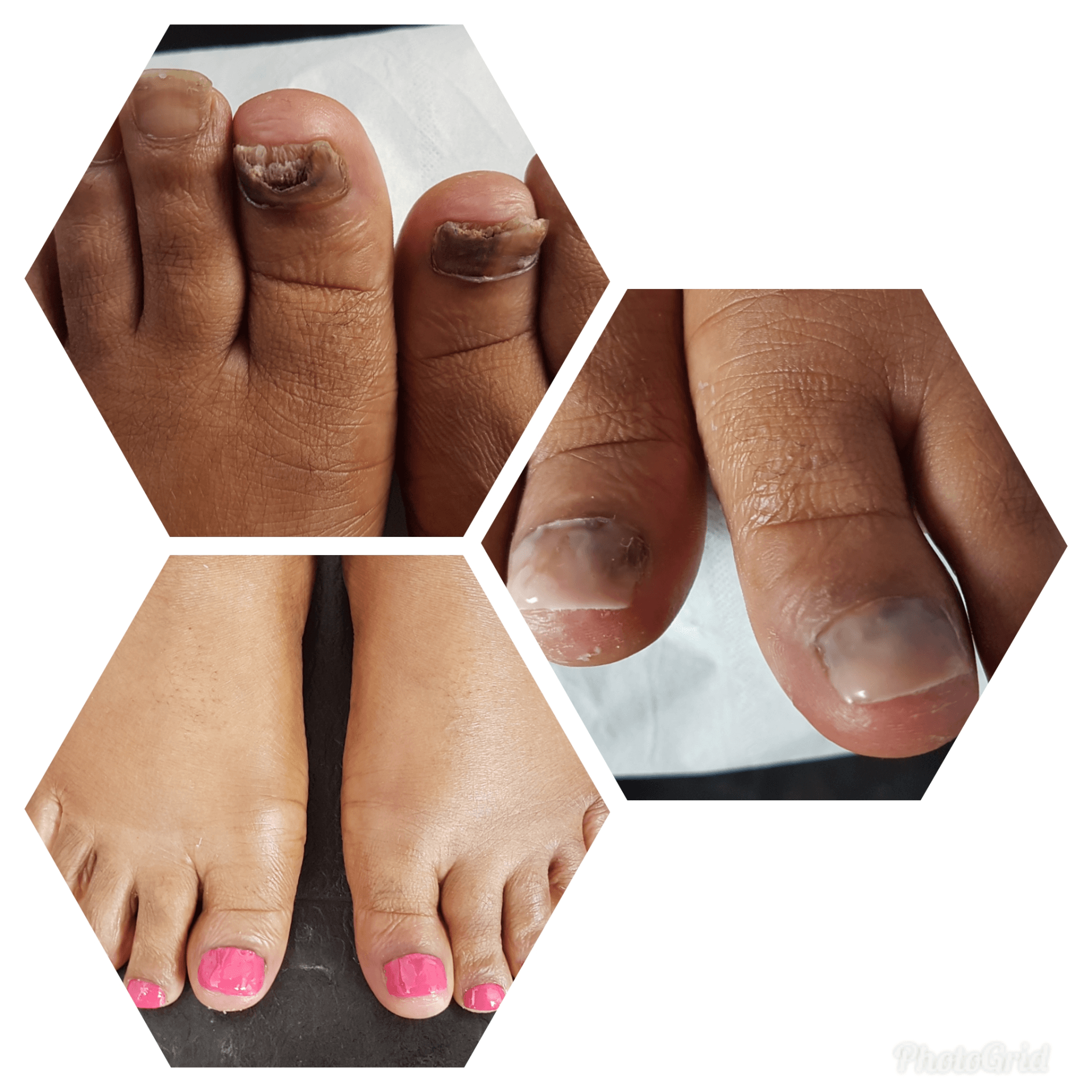 feet 01
